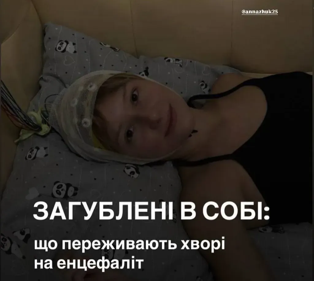 Укус павука перевернув життя: 16-річна дівчина з Умані бореться з енцефалітом та втратою пам’яті